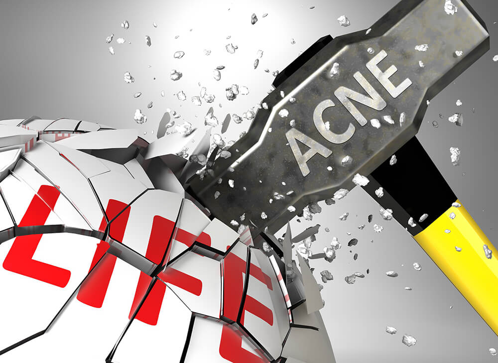 Acne Can Destroy Teenagers' Lives